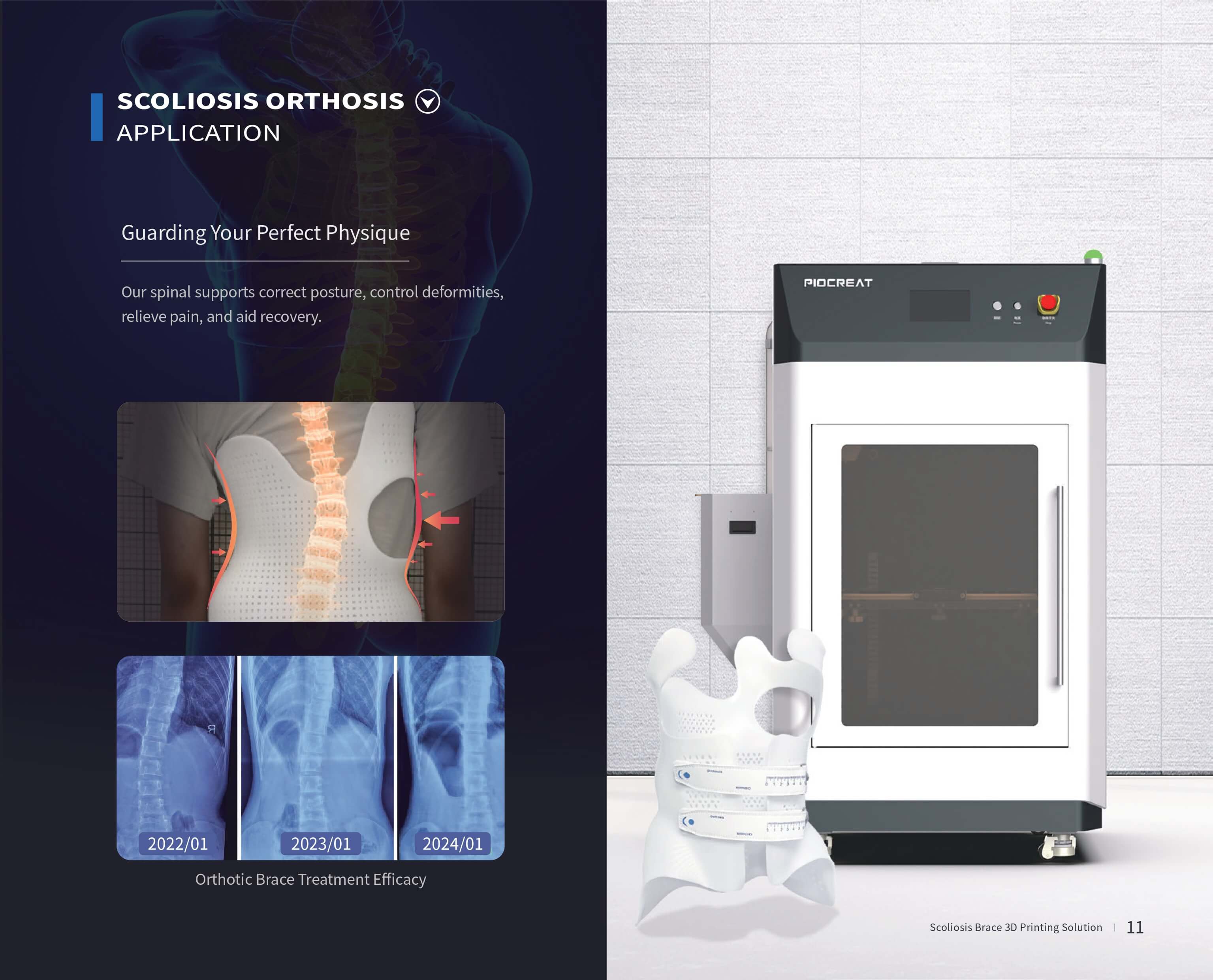 Scoliosis Solutions